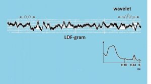 Laser Doppler flowmetry. A methodological complex for the evaluation of periodontal microcirculation