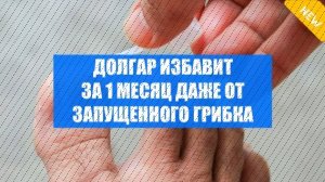 ⚫ ГРИБОК НОГТЯ ГДЕ ЛЕЧИТЬ ⚫ ОТ ГРИБКА НОГТЕЙ ДЕШЕВОЕ СРЕДСТВО ЦЕНА ОТЗЫВЫ