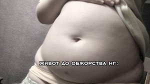 обжорство на нг