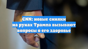 CNN: новые синяки на руках Трампа вызывают вопросы о его здоровье