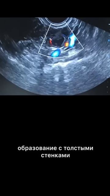 #желтое тело