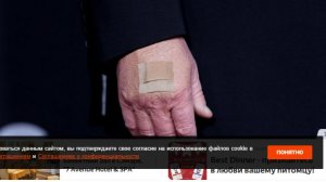 Трамп назвал причину появления синяков на его руках