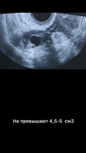 #персистирующий фолликул