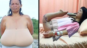 Природа ошиблась? Топ-5 людей с уникальными способностями и телом