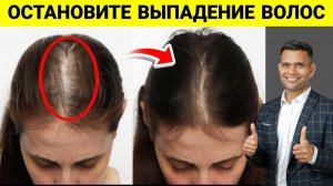 ОСТАНОВИТЕ ВЫПАДЕНИЕ ВОЛОС.