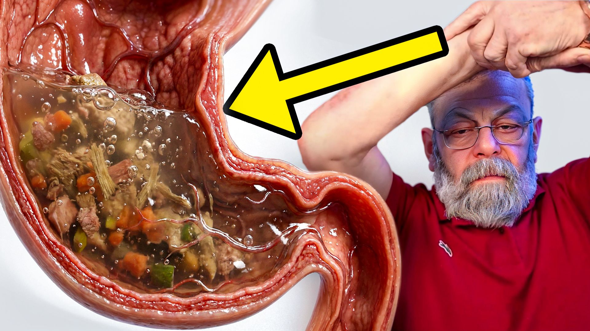 Капельница вместо шампанского смотреть онлайн