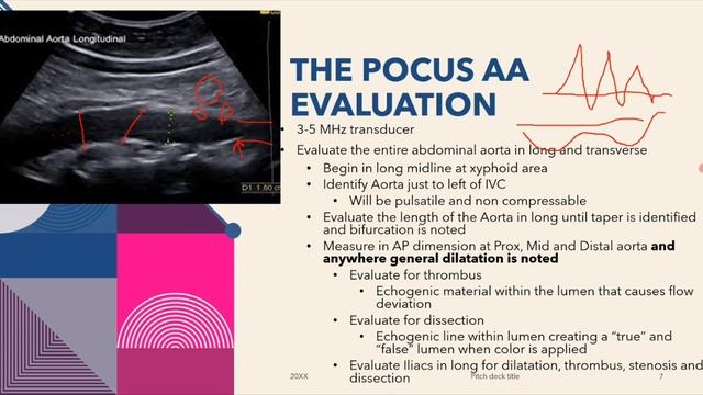 УЗИ аорты 2 лекция рама лекция для врачей