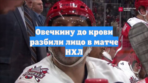 Овечкину разбили лицо в кровь во время матча НХЛ против «Чикаго»