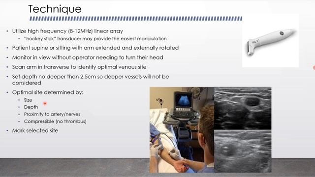 Периферический венозный доступ под контролем УЗИ