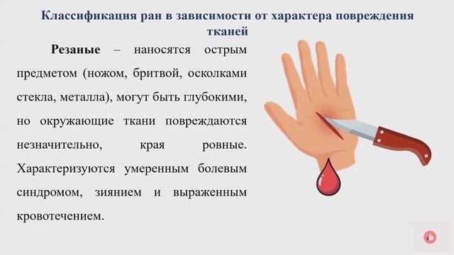 Основные определения, признаки, классификация ран по происхождению смотреть онлайн