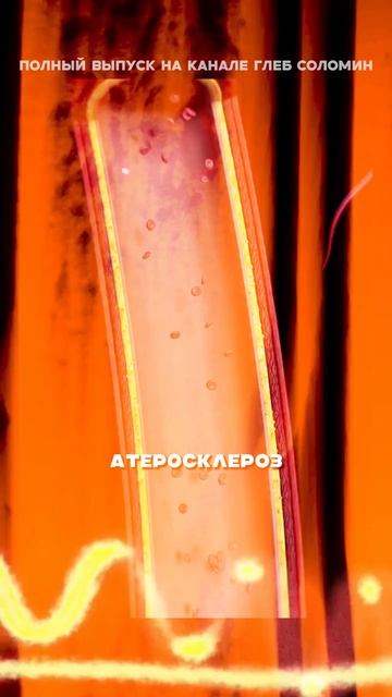 Женщин защищают гормоны от болезней | Гаглошвили | Полный выпуск на канале «Глеб Соломин» смотреть онлайн