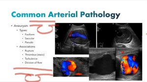 Основы сосудистого УЗИ (рама) лекция для врачей