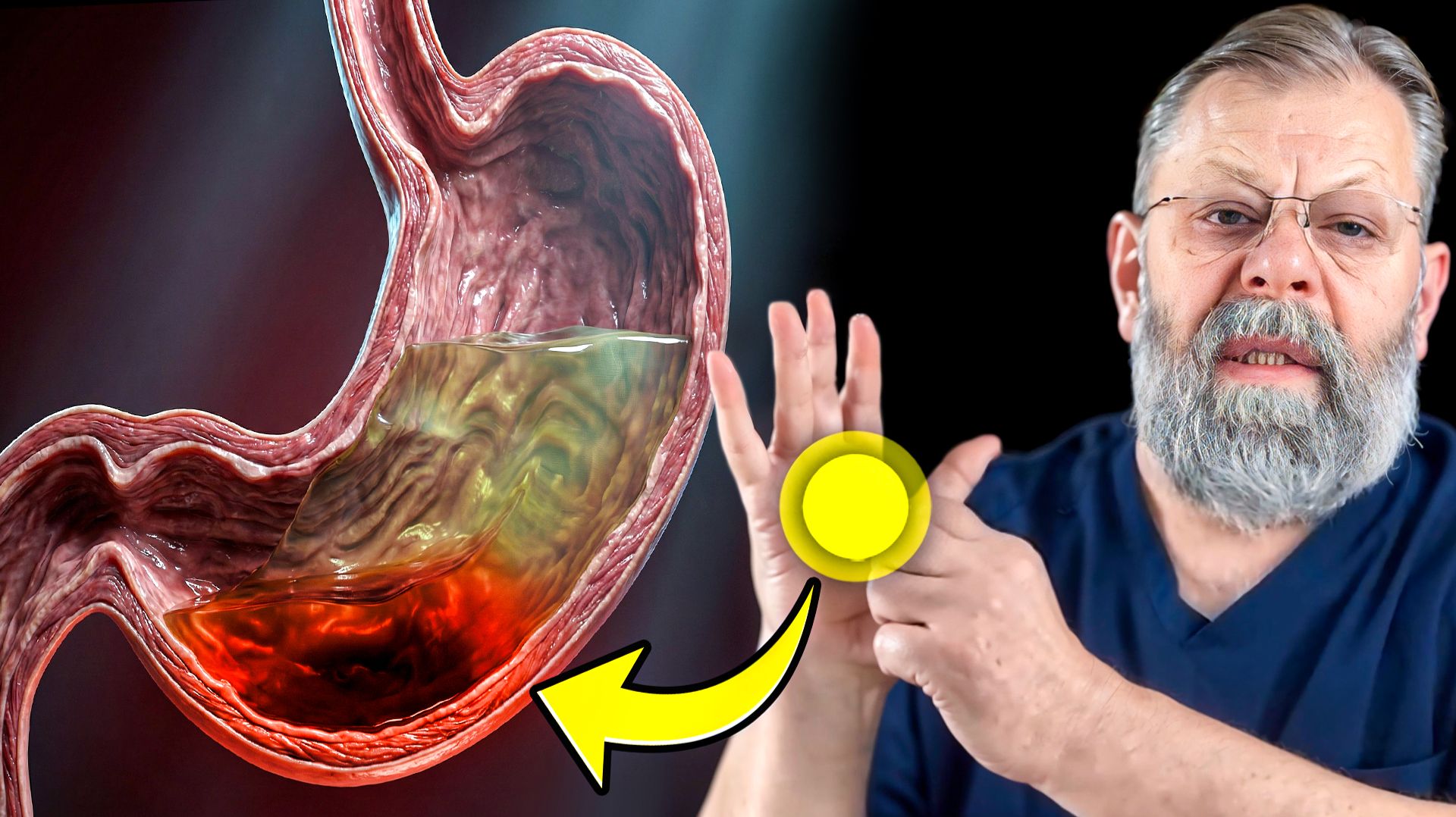 5 упражнений — и ЖКТ спасён! смотреть онлайн