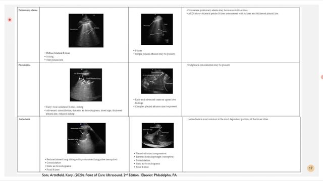 УЗИ легких и плевры лекция 2. рама для врачей УЗИ