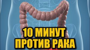 Назван простой способ защиты от рака кишечника