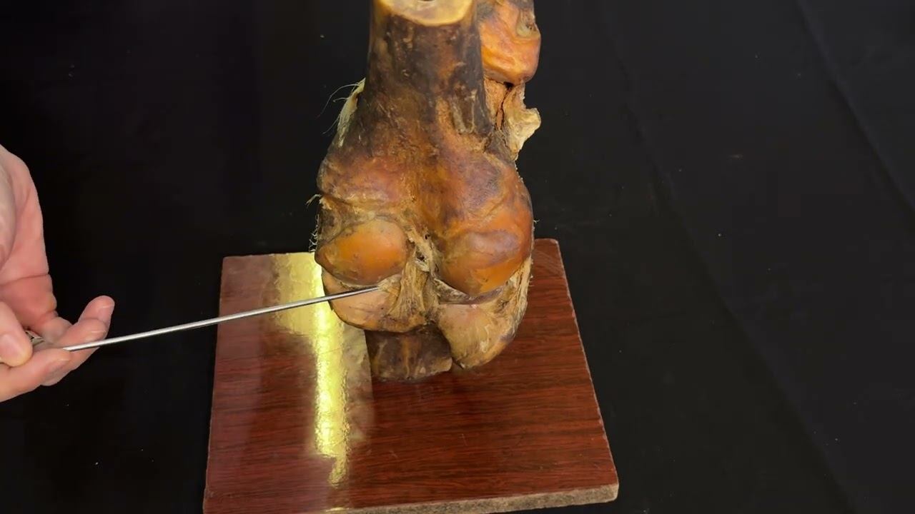 Бедро-берцовый сустав