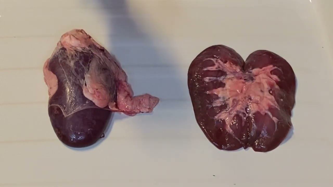 Строение почек (натуральный препарат)