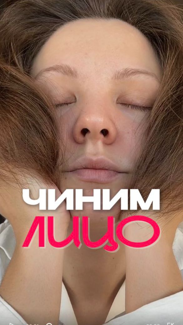 ЧИНИМ ЛИЦО смотреть онлайн