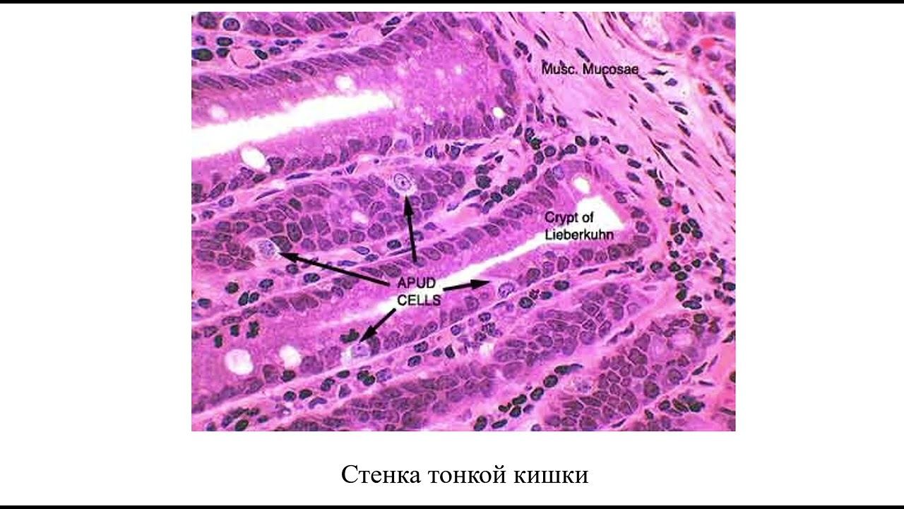 Диффузная эндокринная система