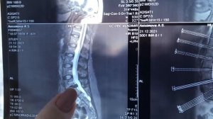 Болит спина от поясницы до крестца / Часть 2 из 3 / Архив от 15.01.2022