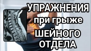 Лечебная физкультура при грыже шейного отдела позвоночника