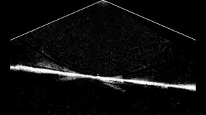 LOWRANCE ActiveTarget Ёлочки