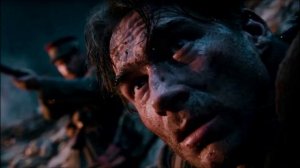 Болят мои ранки