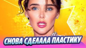 Светлана Сильваши вновь сделала пластику лица 🔥 Новости Шоу-Бизнеса