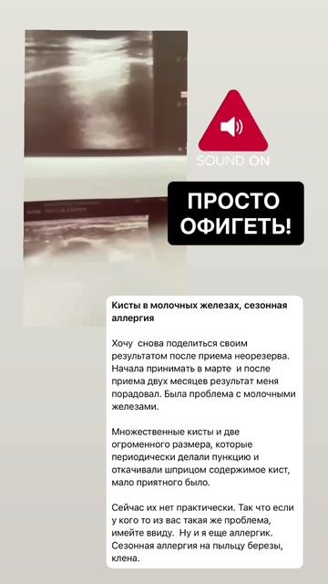 отзыв  NEORESERVO смотреть онлайн