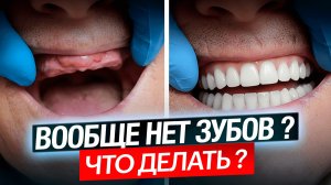 Остались без зубов: съёмные протезы или импланты — что выбрать?