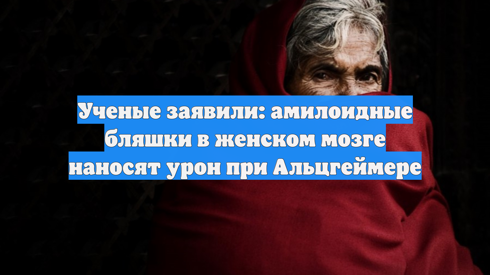 Ученые заявили: амилоидные бляшки в женском мозге наносят урон при Альцгеймере смотреть онлайн