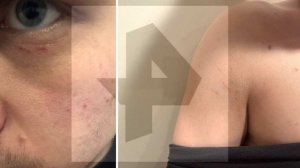 Корреспондента РЕН ТВ незаконно задержали во время рейда на фестивале в Москве