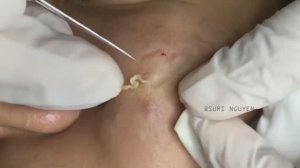 Ух ты! Белые точки "со стажем". Экстракция