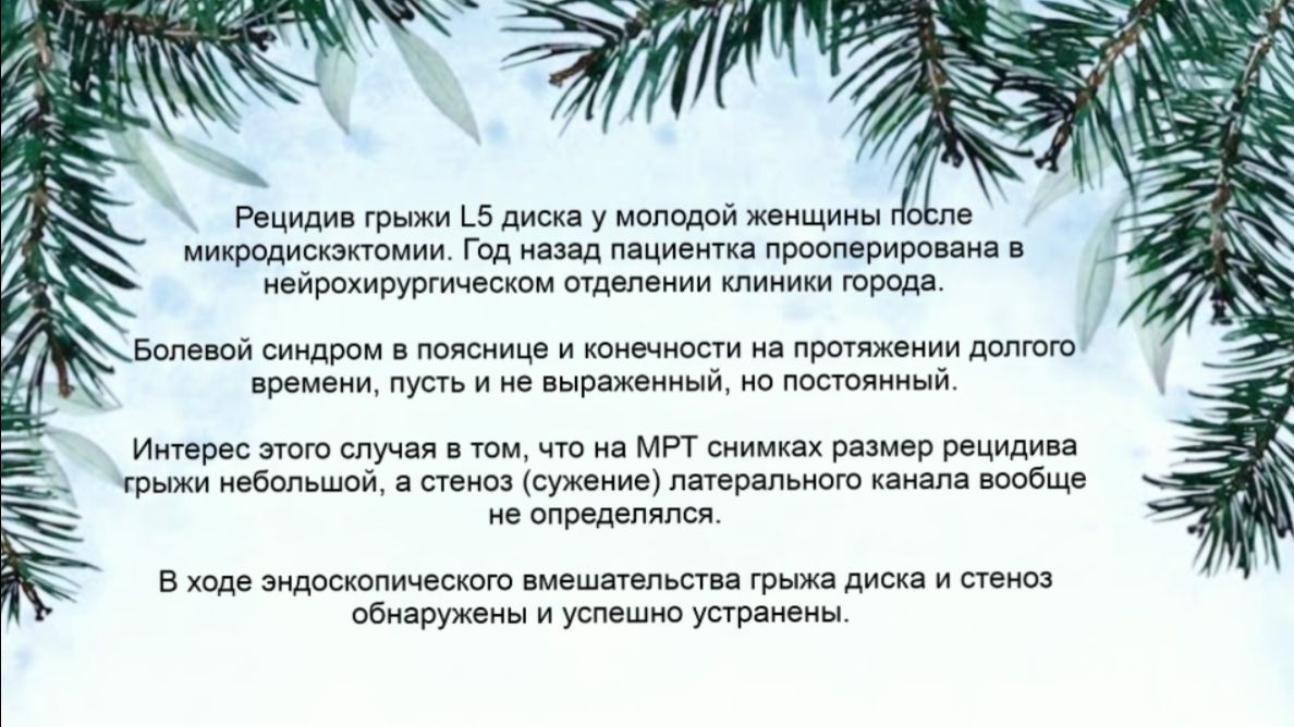 Рецидив грыжи диска L5 со стенозом латерального канала смотреть онлайн