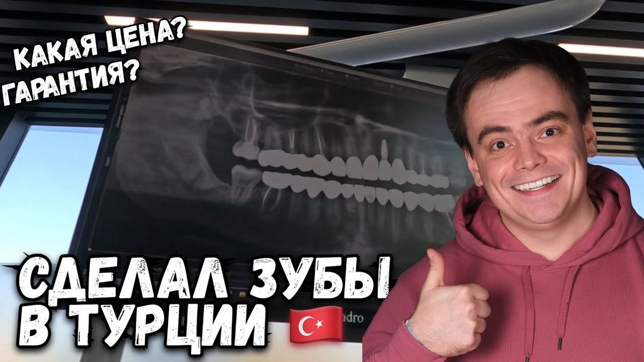 СДЕЛАЛ ЗУБЫ В ТУРЦИИ. СКОЛЬКО СТОИТ ГОЛЛИВУДСКАЯ УЛЫБКА? смотреть онлайн