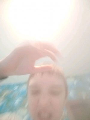 меня бьёт током если я смеюсь