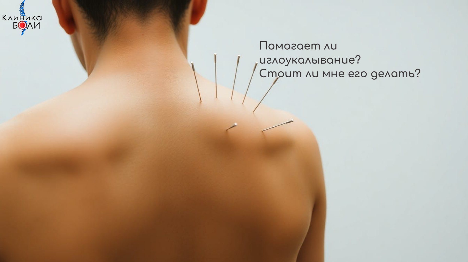 Помогает ли иглоукалывание? Стоит ли мне его делать? смотреть онлайн