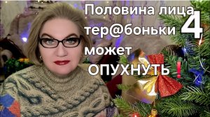 Половина лица тер@боньки может ОПУХНУТЬ❗️
