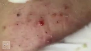 Потрясающие черные точки... это стоит посмотреть!