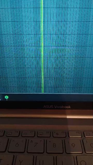 стрим вайт фокс смотреть онлайн