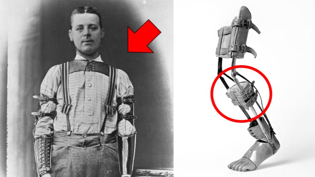 ⚡Тайна протезов 19 века