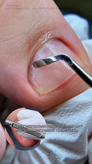 тампонада после покрытия гель лака ❤️