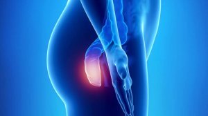 Лечение геморроя