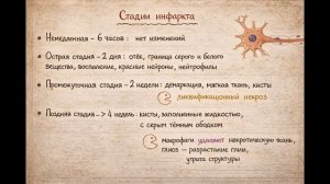 Инсульт. Часть 2