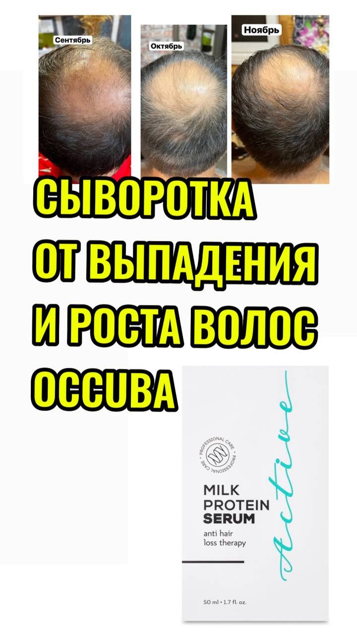 Сыворотка для роста волос.