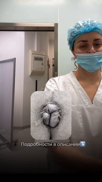 Мужчинам труднее дойти до проктолога - стыдно, страшно, неудобно #проктолог смотреть онлайн