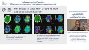 Лучевые мет визуализации в  нетравматического САК Семенцова О.В. 2025