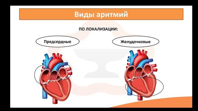 Лекция 3.1 Патология сердечно-сосудистой системы. Аритмии смотреть онлайн