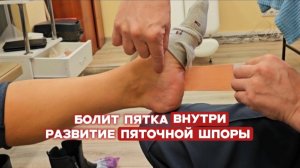 Избавляемся от режущей боли в пятке и останавливаем развитие пяточной шпоры техникой тейпирования