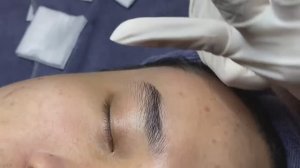 Relax Acne 015 • АСМР • Loan Nguyen collection